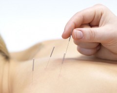 Massatges acupuntura
